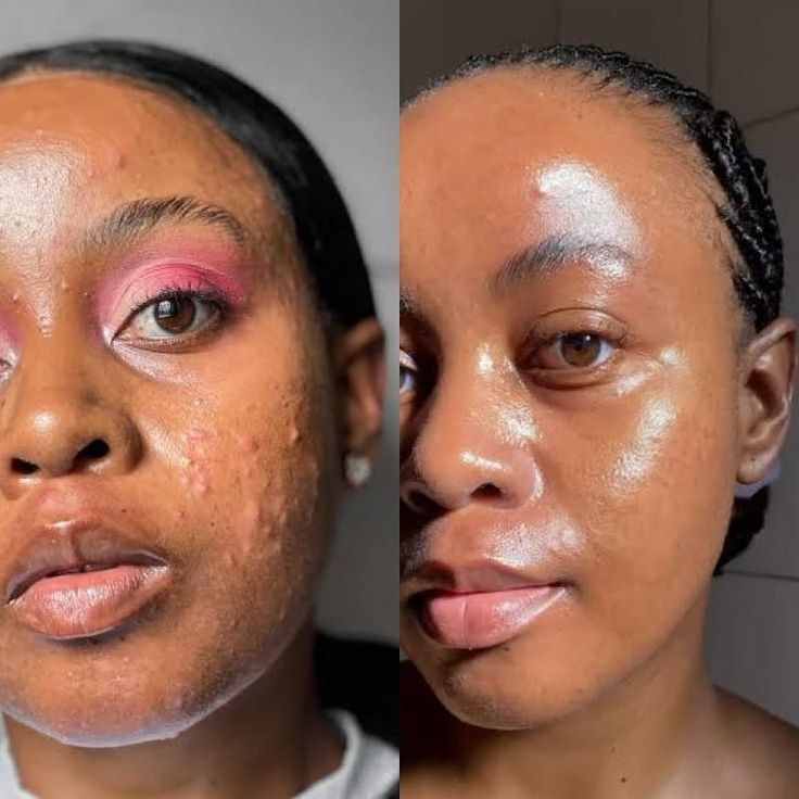 911c2cf7e33781a5b8993085c210f881