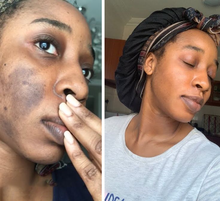 8189ca387c210a68df04ded98a51abdb