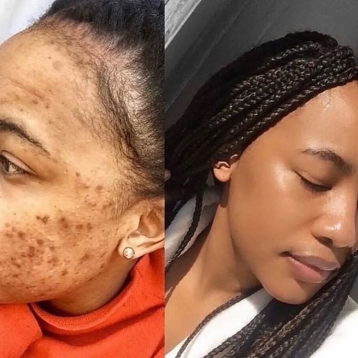 9e73f111bcc34ffc571d01232238d560