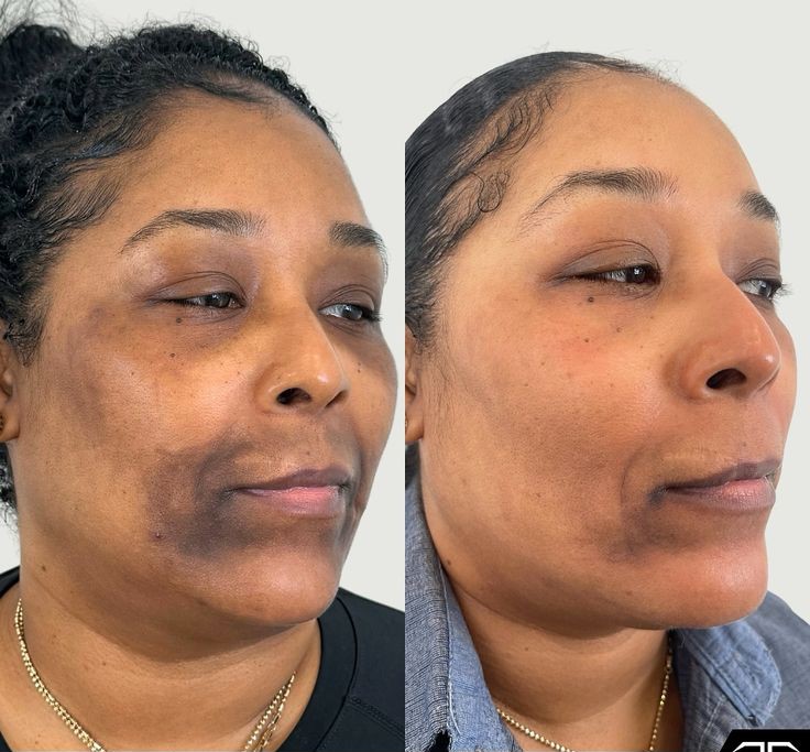 e54eb5c9a819dfdc6b6d0d58c5b2d53e~2