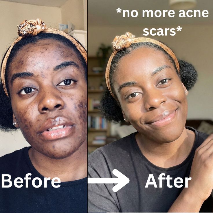 3e1b4d2eafe9d4c655a9febc7b589332