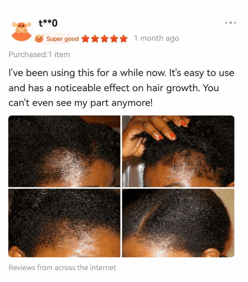 Black woman showing gradual edges and hairline progress in four photos